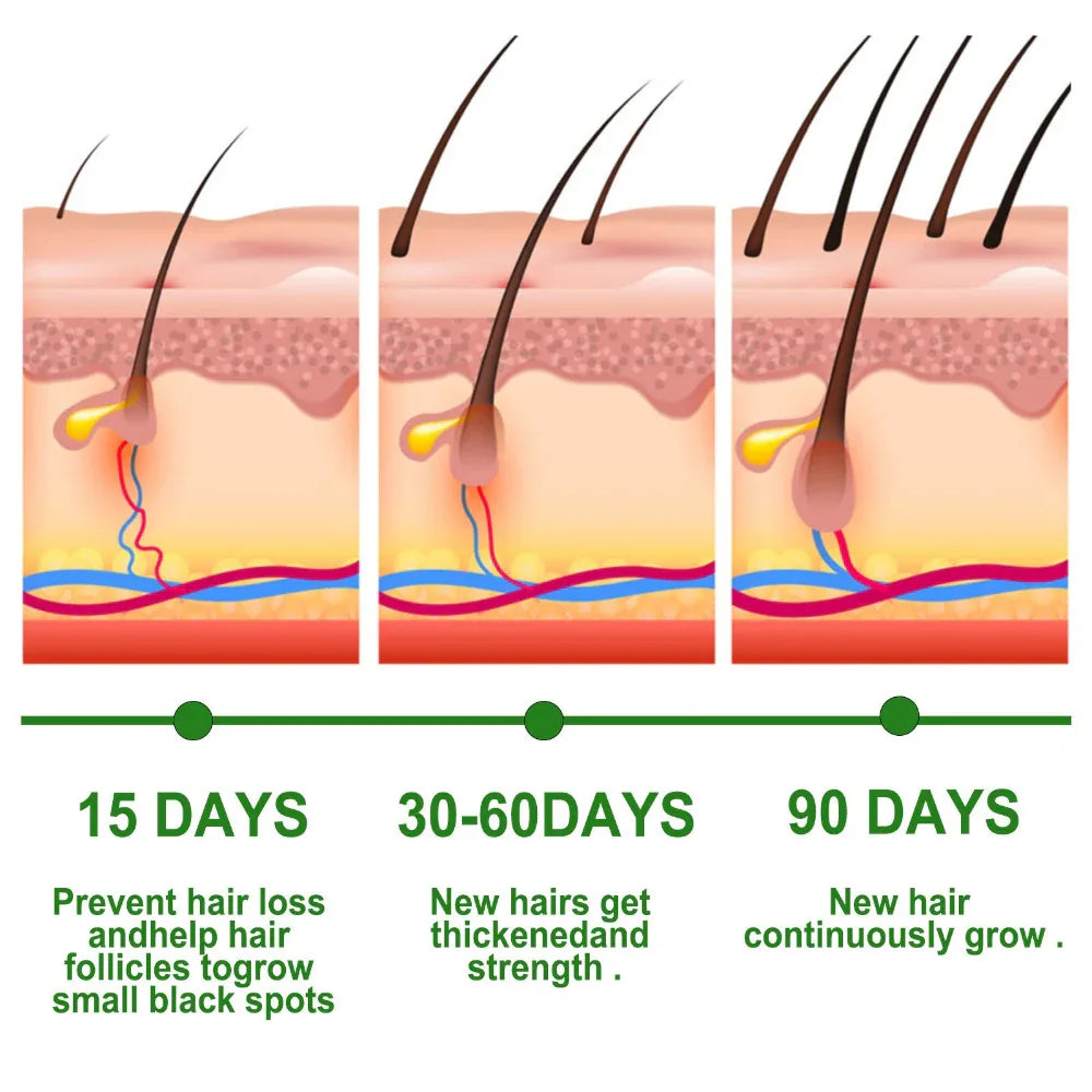 Rosemary Hair Care Essential Oil Anti Hair Loss Nourish Scalp Hair Roots For Growth